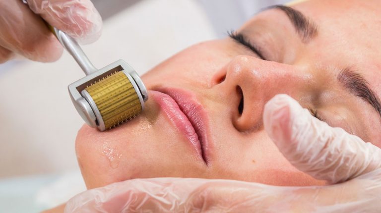 dermaroller rolling in patients skin