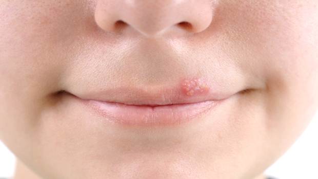 warts in skin