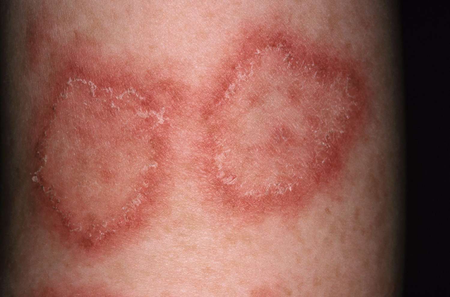 skin issues